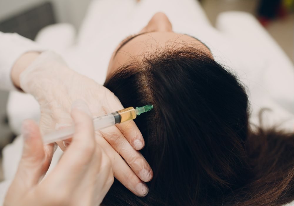 Preços da Mesoterapia Capilar e Como Funciona