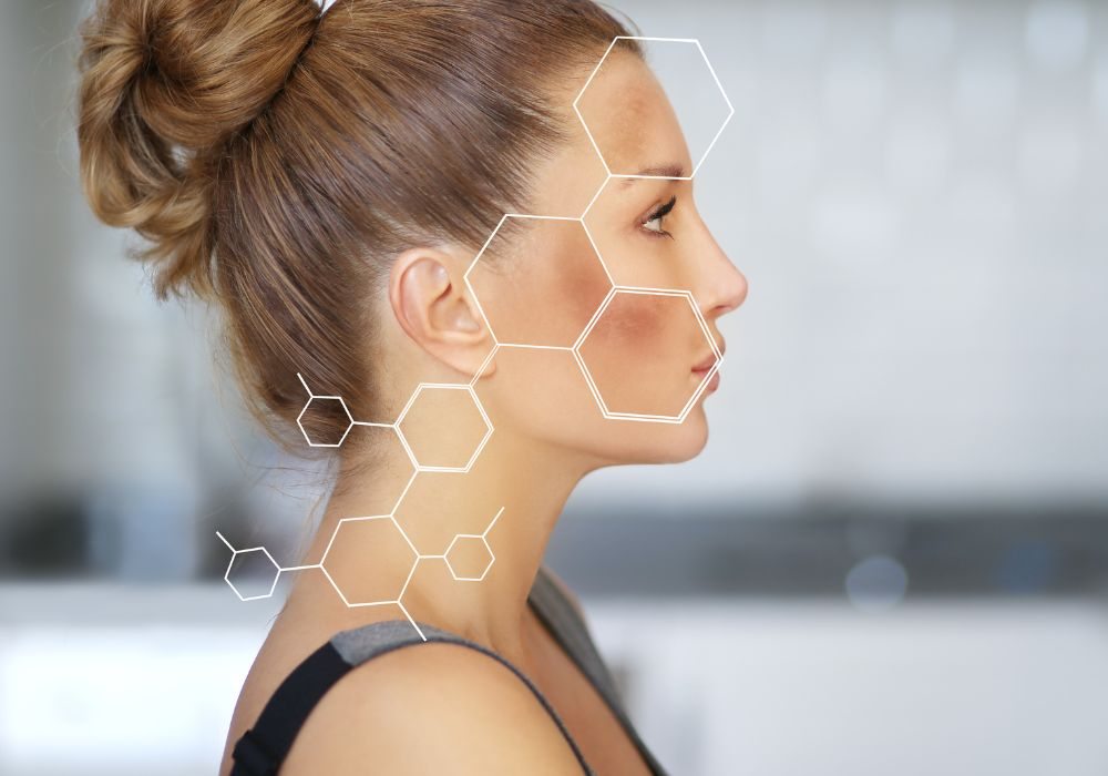 O que é o Melasma e Quais os Melhores Produtos para Tratar