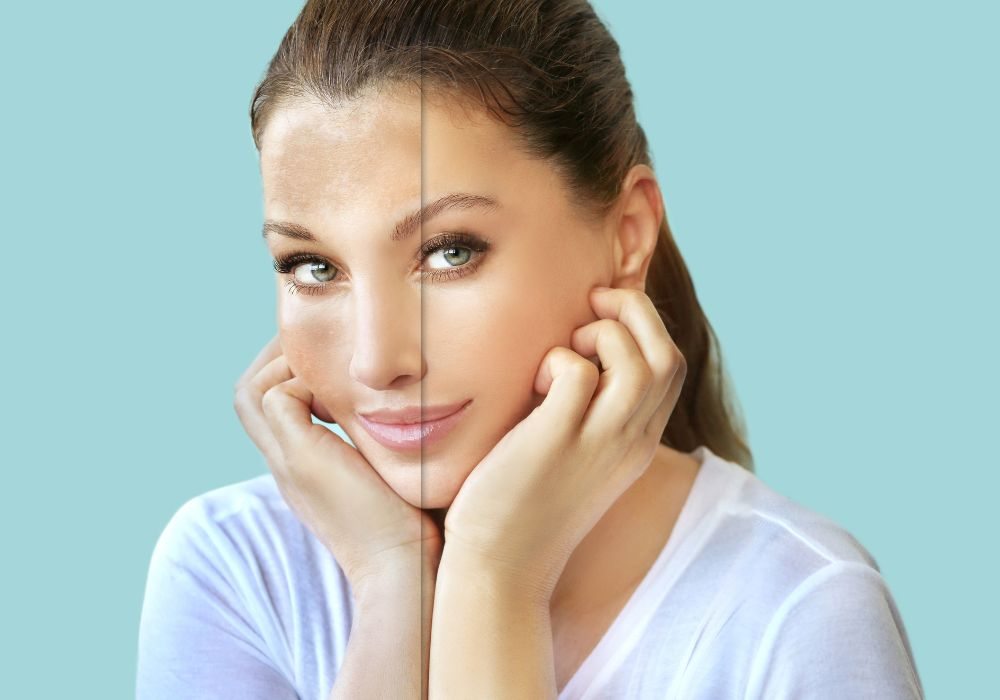 Alpha Arbutin O Que é, Para Que Serve e Melhores Produtos