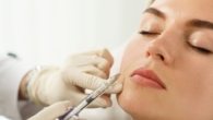 Preenchimento Facial O Que É, Como Funciona e Quanto Custa em 2025