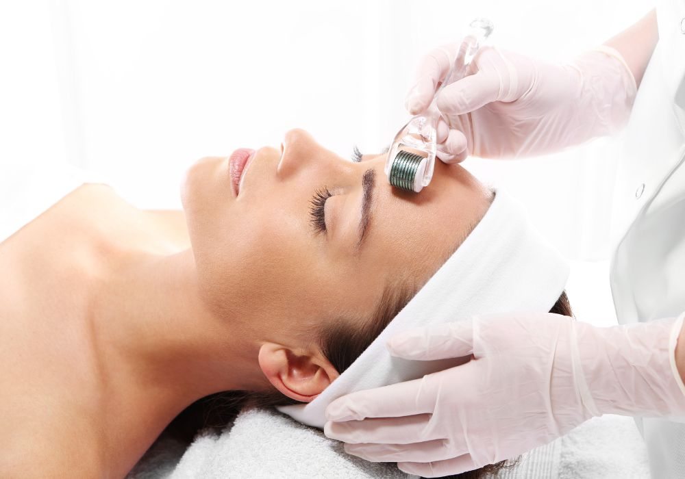 Microagulhamento Dermaroller ou Dermapen Quanto Custa em Média